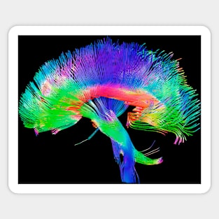 Brain pathways (P335/0069) Sticker